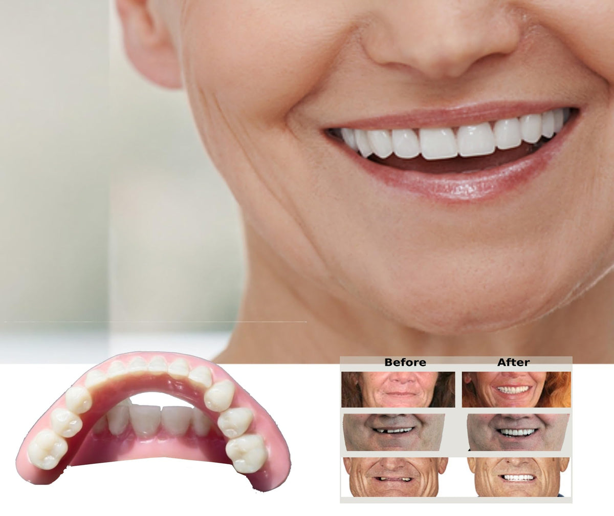 DIY Dentures Kit X55671