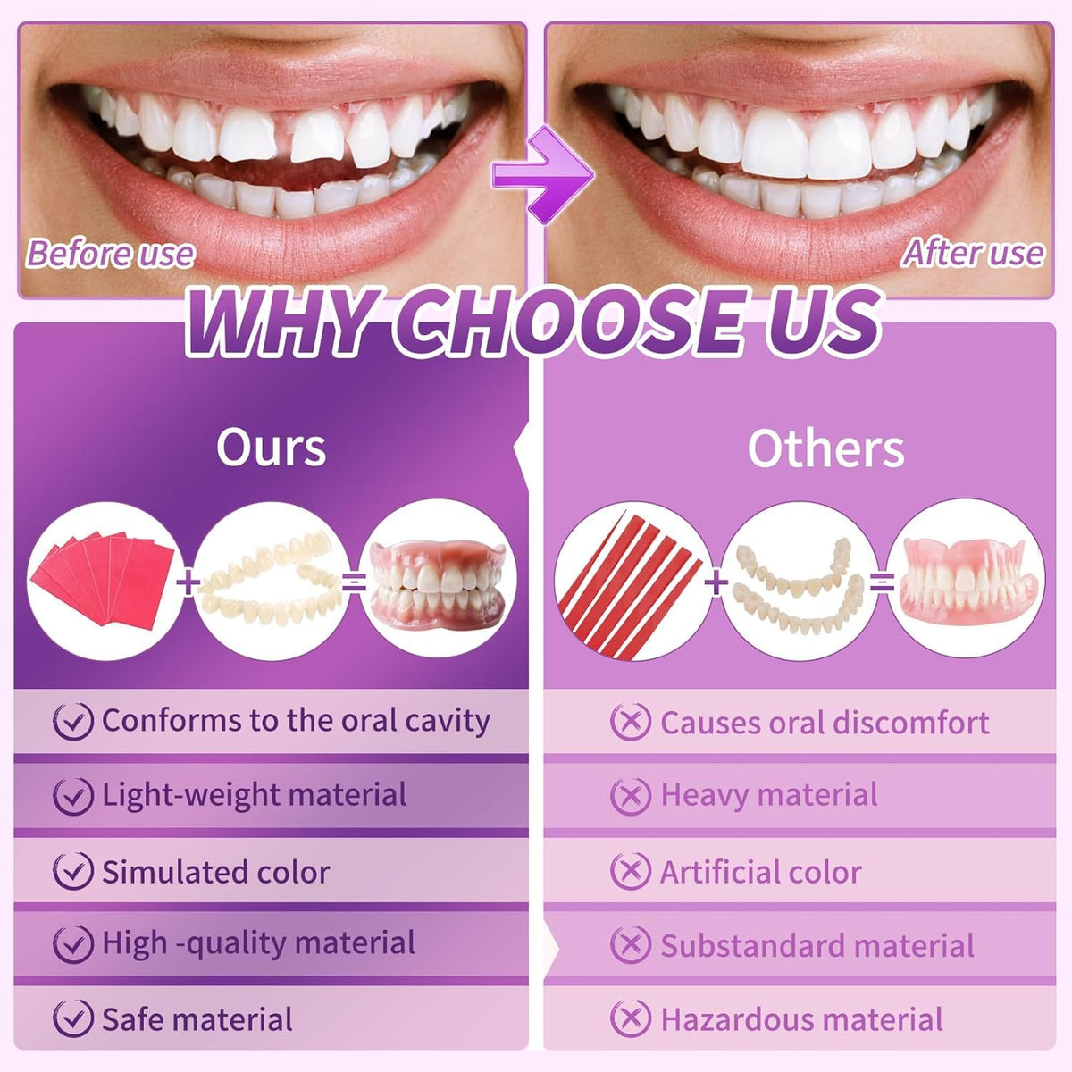 DIY Denture Kit E80661